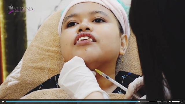 dari filler hidung hingga suntik tiruskan wajah ini 4 potret kekeyi jalani perawatan kecantikan