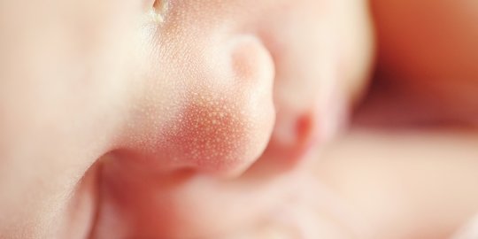 Penyebab Bayi Muntah Darah yang Perlu Diwaspadai, Orang Tua Wajib Tahu
