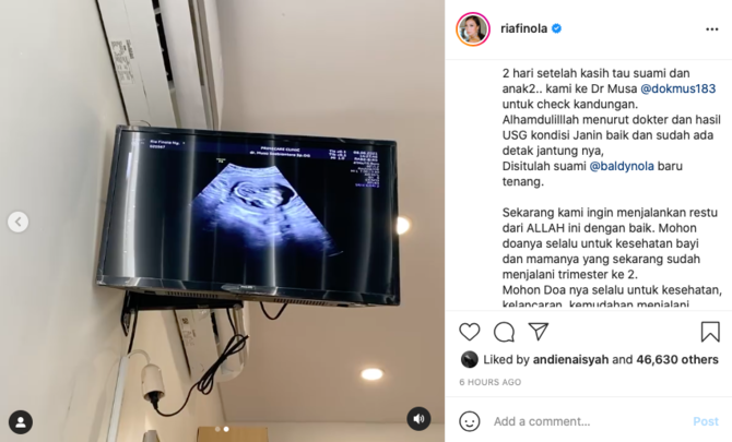 nola b3 umumkan hamil anak ke 4 begini reaksi tak terduga anggota keluarga