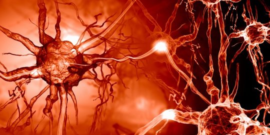 histoplasmosis dan multiple sclerosis