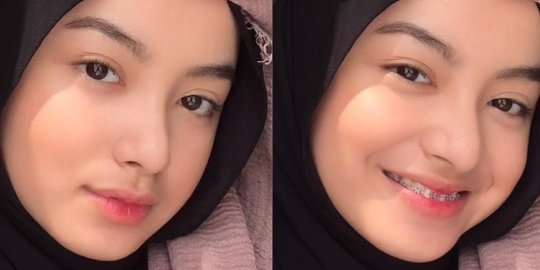 5 Potret Nabila Putri Calon Menantu Ucok Baba, Selebgram Cantik Pemilik Senyum Manis