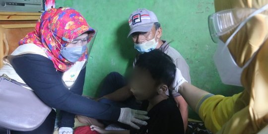 Kemensos Respons Anak dengan Kondisi Suspect Kanker Wajah di Bekasi