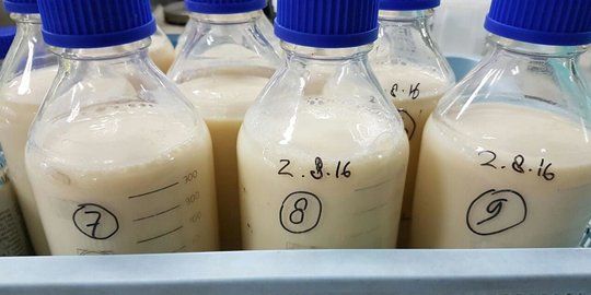 Susu Buatan UGM Ini Diyakini Mampu Turunkan Kolesterol, Ini Faktanya