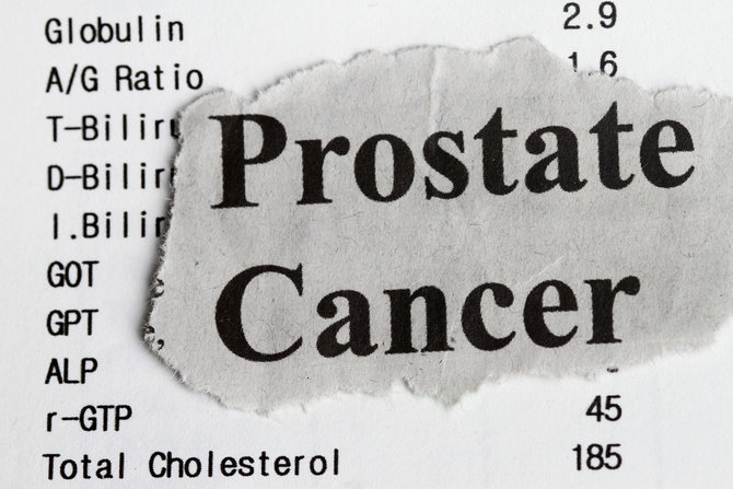 ilustrasi kanker prostat