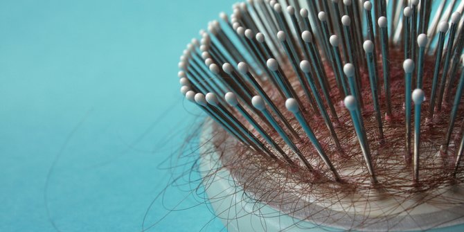 Ketahui Arti Mimpi Rambut Rontok, Pertanda Baik Atau Buruk? Halaman 2 |  Merdeka.com