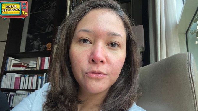 sempat kena penyakit kulit amp sembuh ini alasan maia estianty buka klinik kecantikan