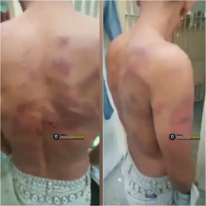 viral diduga aksi kekerasan petugas ke tahanan di lapas medan ini kata kalapas