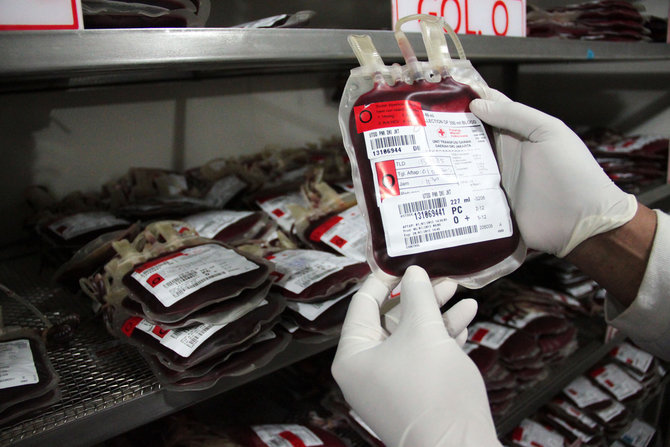 Transfusi darah dari donor yang bergolongan darah a ke resipien yang bergolongan darah b, menyebabka