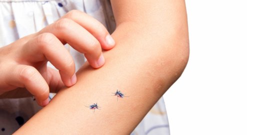 7 Cara Menghilangkan Bekas Gigitan Nyamuk yang Sudah Menghitam pada Orang Dewasa