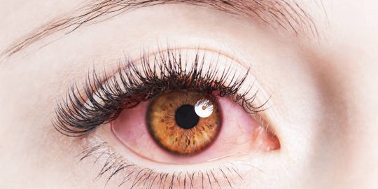 Beware of Dry Eye Syndrome Stalks the Impact of Hours in Front of a Device While WFH