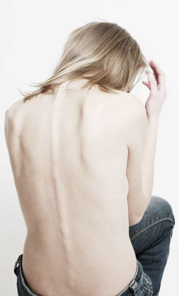 ilustrasi anoreksia
