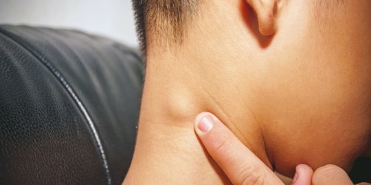 Limfadenopati adalah Pembengkakan Kelenjar Getah Bening, Kenali Gejalanya