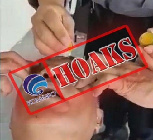 hoaks air jeruk nipis bisa mengurangi mata minus