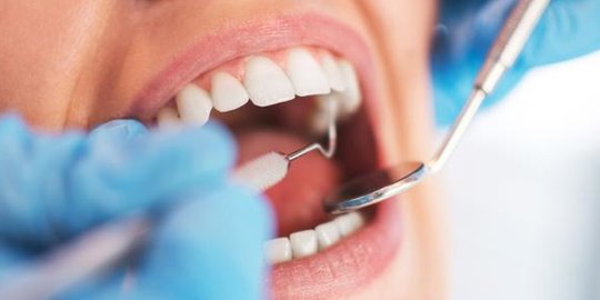 Cara Menghilangkan Karang Gigi yang Sudah Mengeras, Bisa dengan Bahan Alami