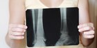 Ma'ruf Ajak Masyarakat Cegah Osteoporosis dengan Pola Hidup Sehat