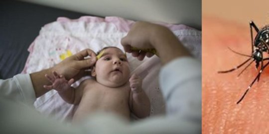 India Waspada Wabah Virus Zika Setelah 89 Kasus Ditemukan di Kota Kanpur