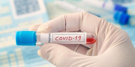 Update Kasus Harian Covid-19 dan Capaian Vaksinasi per 19 November 2021
