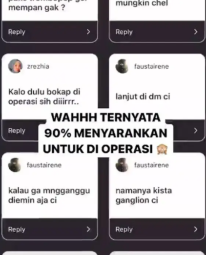 chelsea olivia jalani operasi akibat benjolan di tangan begini kondisinya