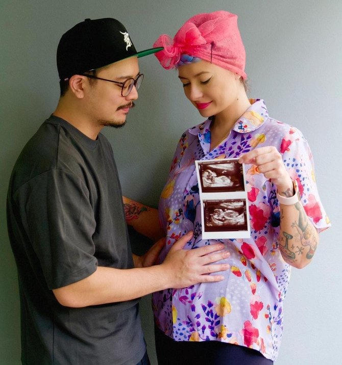 derby romero umumkan istri tercinta hamil anak pertama ini potretnya