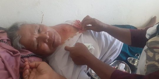 Banyak Ibu-Ibu jadi Korban Penembakan di Desa Tamilouw, Ini Kata Polda Maluku