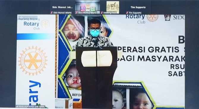 hadirkan senyum untuk anak sido muncul gelar operasi bibir sumbing gratis di tegal