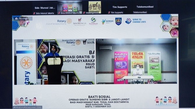 hadirkan senyum untuk anak sido muncul gelar operasi bibir sumbing gratis di tegal