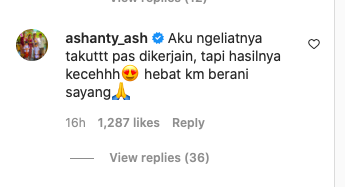 anang hermansyah jalani transplantasi rambut begini respons ashanty