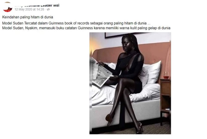 tidak benar model ini memegang rekor dunia karena warna kulitnya