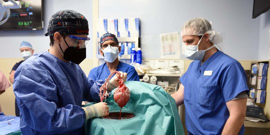 Pertama Di Dunia, Dokter Bedah AS Berhasil Cangkok Jantung Babi Pada ...