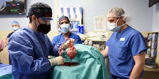 Tim Dokter AS Berhasil Cangkok Jantung Babi pada Manusia