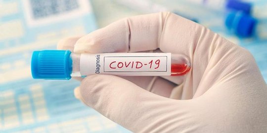 SMAN 6 Jakarta Setop PTM 5 Hari Usai Ada Siswa Positif Covid-19
