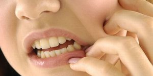 Cara mengobati sakit gigi berlubang