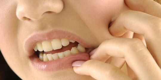 Penyebab Erosi Gigi yang Perlu Diketahui, Ini Gejala dan Cara Mencegahnya