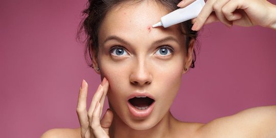 Cara Membersihkan Jerawat dengan Mudah, Tak Hanya dengan Skincare