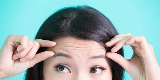 Belum Tentu Penuaan, Ini 6 Penyebab Kerutan Dahi di Usia Muda dan Cara Mencegahnya
