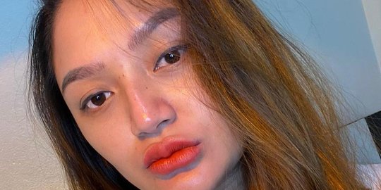 Hamil Besar, Ini Kondisi Terbaru Siti Badriah Usai Positif Covid-19