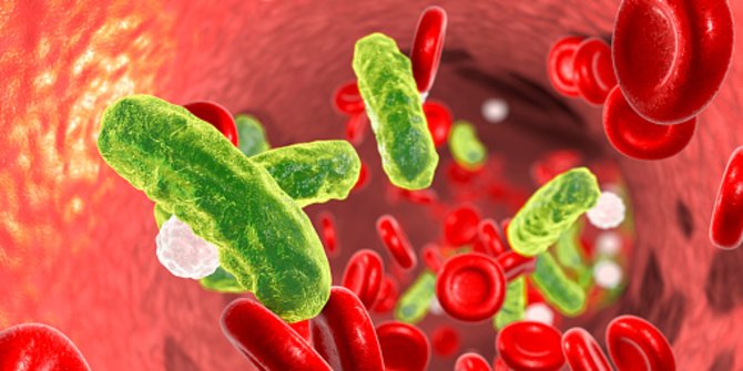 Gambar illustrasi penyakit Septikemia