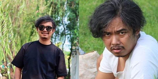 Sukses jadi Komika Stand-Up, Dodit Mulyanto Ungkap Masa Terendahnya