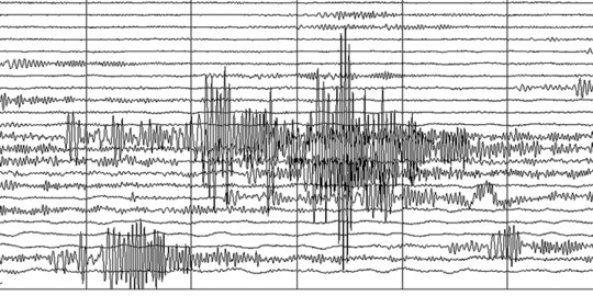 Ruteng Diguncang Gempa Sebanyak 8 Kali Sejak 20 Februari 2022