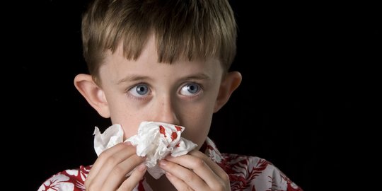 Cara Mengatasi Mimisan pada Anak, Kenali Penyebabnya Lebih Awal