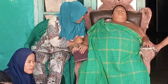 Bocah 11 Tahun di Bekasi Beratnya 115 Kg, Hobi Makan Mi dan Jajan Es