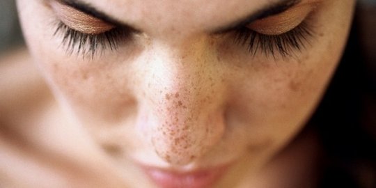 8 Cara Menghilangkan Flek Hitam di Hidung dan Pipi Secara Alami, Dijamin Ampuh