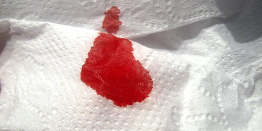 Ketahui Hormon yang Berperan dalam Siklus Menstruasi, Ini Tahapannya