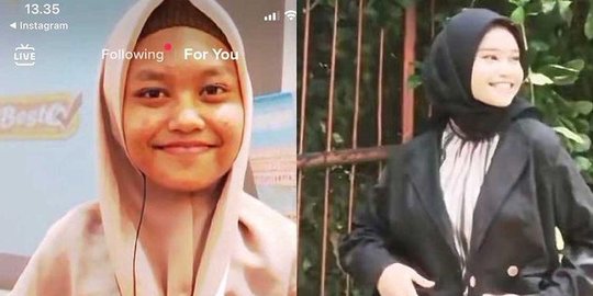 Dihina Jelek & Diselingkuhi Pacar, Gadis Ini Sukses Glow Up Hingga Jadi Puteri Banten
