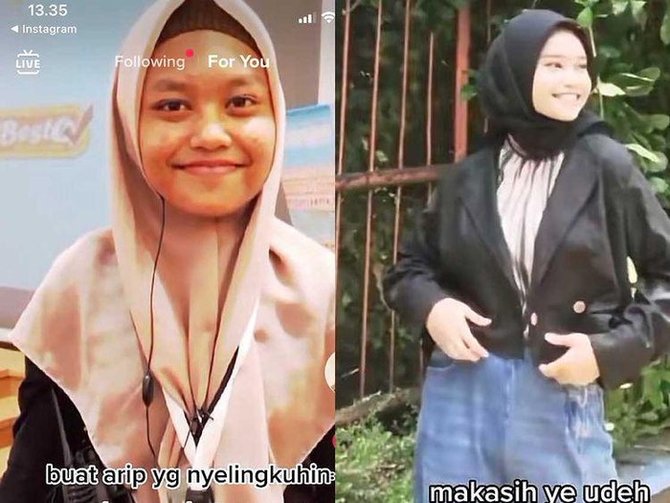 cerita gadis berhasil glowup