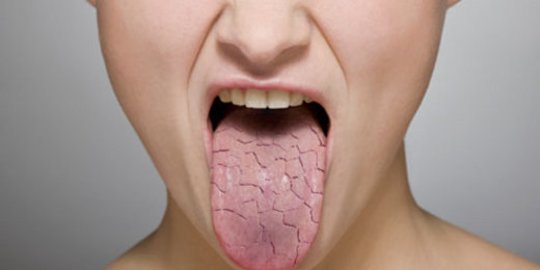 5 Jenis Makanan Penyebab Mulut Kering saat Berpuasa, Perlu Dikurangi