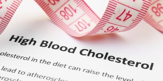Cara Mengatasi Kolesterol Tinggi, Kenali Penyebabnya Sejak Dini