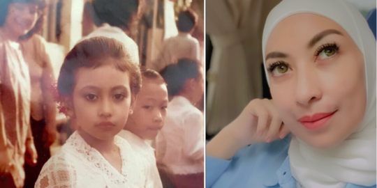 Foto Kecilnya Curi Perhatian, Intip Transformasi Annisa Trihapsari yang Kini Hamil