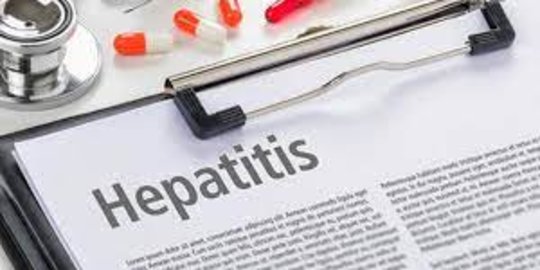 Pakar Sebut Temuan Hepatitis Akut Belum Tentu Jadi Pandemi