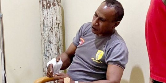 Demo Tolak DOB Ricuh, Tangan Kasat Polair Polres Jayapura Patah Dilempar Batu